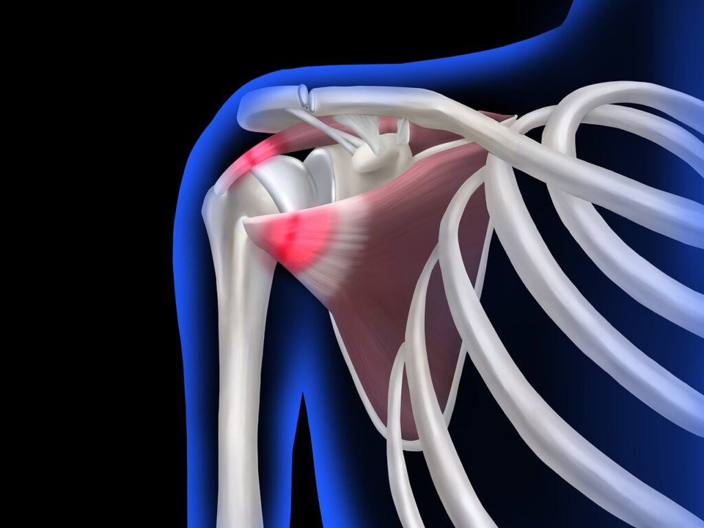 Joint Pain In Men
